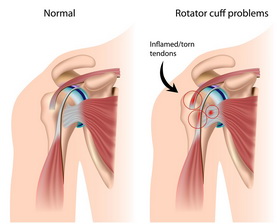 Seat Belt Injury Symptoms & Treatment