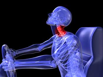 Whiplash injury caused from auto accident