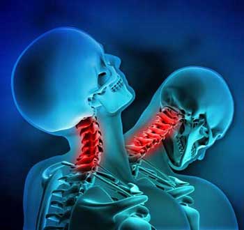 back pain injury caused from decatur car wreck