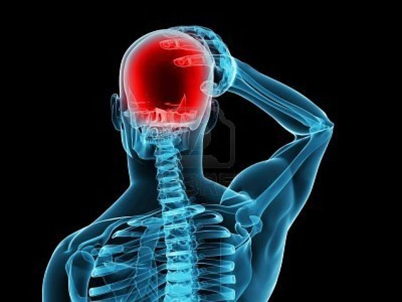 headaches and head injuries